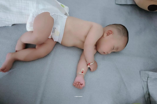 榆林六个月宝宝眼睛散光